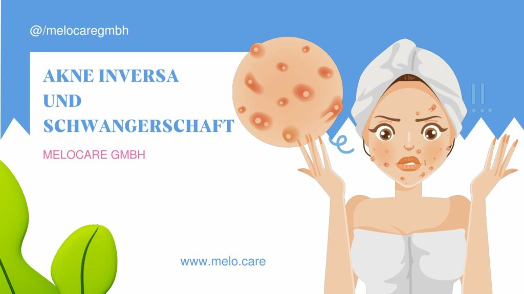 Akne Inversa und Schwangerschaft