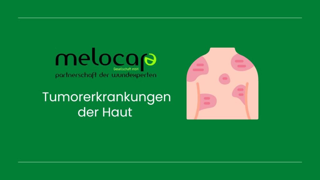 Tumorerkrankungen der Haut